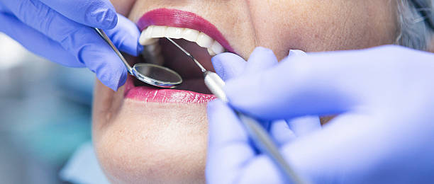 Best Emergency Treatment for Dental Infections or Abscesses in Webster City, IA